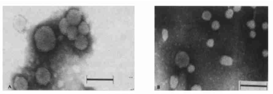 柔性纳米脂质体(A)和普通纳米脂质体(B)透射电镜观察结果 柔性纳米脂质体(A)和普通纳米脂质体(B)透射电镜观察结果